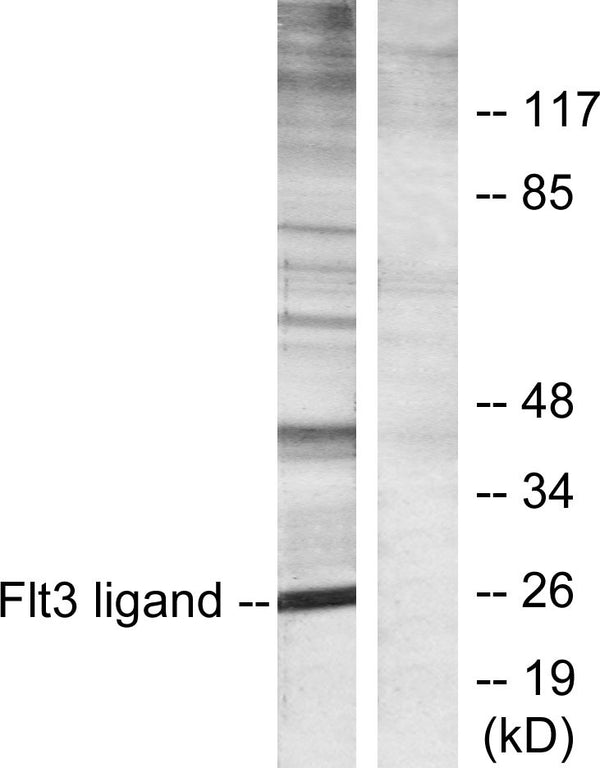 Anti-FLT3LG antibody (171-220 aa) (STJ93096) – Figure 1 of 1