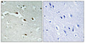 Anti-FOXJ1 antibody (271-320 aa) (STJ93116) – Figure 1 of 1