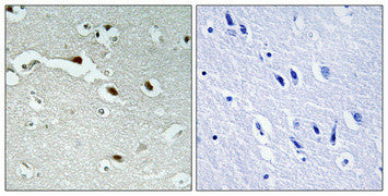 Anti-FOXJ1 antibody (271-320 aa) (STJ93116) – Figure 1 of 1