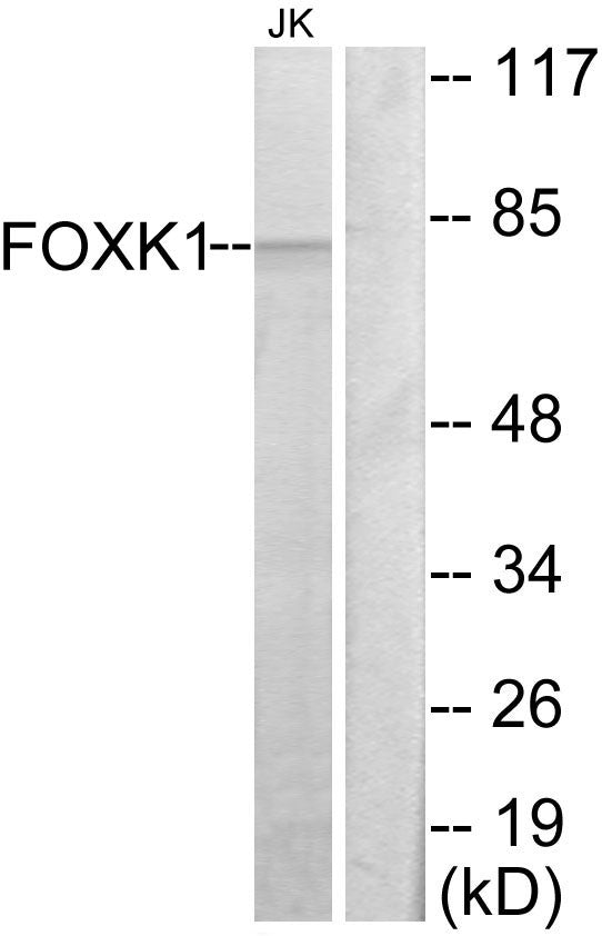 Anti-FOXK1 antibody (681-730 aa) (STJ93118) – Figure 1 of 1