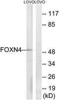 Anti-FOXN4 antibody (411-460 aa) (STJ93121) – Figure 1 of 1