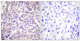Anti-FOXO1 antibody (295-344 aa) (STJ93126) – Figure 1 of 1