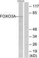 Anti-FOXO3 antibody (220-269 aa) (STJ93128) – Figure 1 of 1