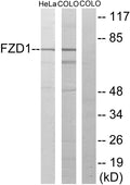 Anti-FZD1 antibody (15-64 aa) (STJ93138) – Figure 1 of 1