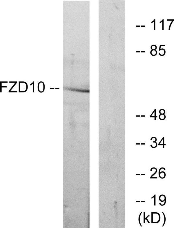 Anti-FZD10 antibody (135-184 aa) (STJ93140) – Figure 1 of 1