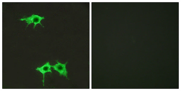 Anti-FZD4 antibody (131-180 aa) (STJ93144) – Figure 1 of 1