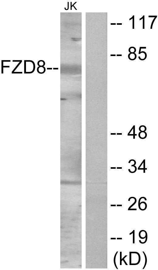 Anti-Frizzled-5/8 antibody (31-80 aa) (STJ93148) – Figure 1 of 1