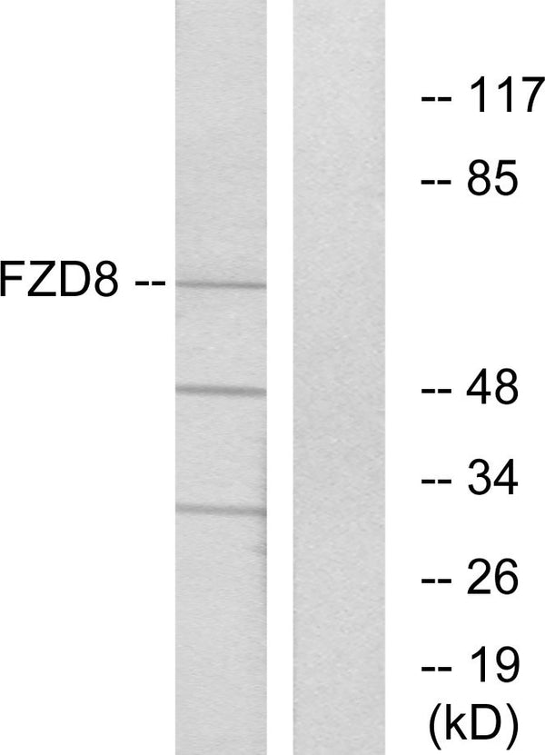 Anti-FZD8 antibody (486-535 aa) (STJ93152) – Figure 1 of 1