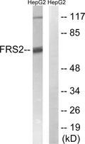 Anti-FRS2 antibody (162-211 aa) (STJ93156) – Figure 1 of 1