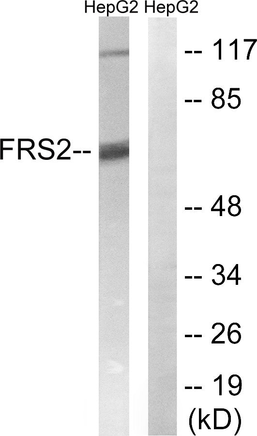 Anti-FRS2 antibody (162-211 aa) (STJ93156) – Figure 1 of 1