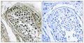 Anti-Gab 2/4 antibody (21-70 aa) (STJ93183) – Figure 1 of 1