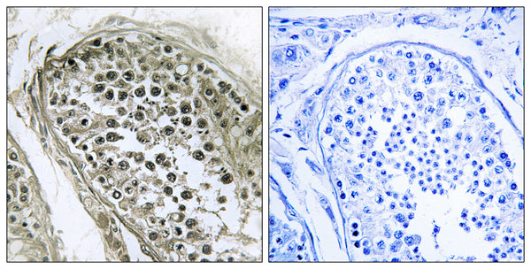 Anti-Gab 2/4 antibody (21-70 aa) (STJ93183) – Figure 1 of 1