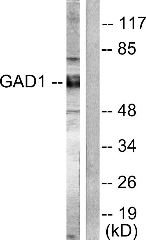Anti-GAD-65/67 antibody (545-594 aa) (STJ93195) – Figure 1 of 1