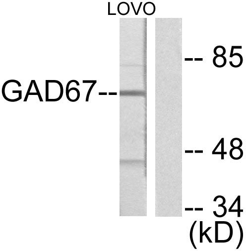 Anti-GAD1 antibody (471-520 aa) (STJ93196) – Figure 1 of 1