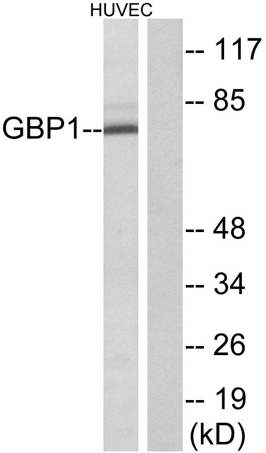 Anti-GBP1 antibody (71-120 aa) (STJ93232) – Figure 1 of 1