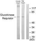 Anti-GCKR antibody (211-260 aa) (STJ93238) – Figure 1 of 1
