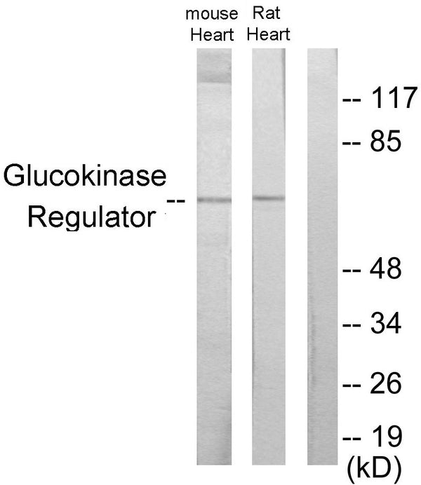 Anti-GCKR antibody (211-260 aa) (STJ93238) – Figure 1 of 1