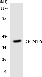 Anti-GCNT6 antibody (201-250 aa) (STJ93242) – Figure 1 of 1
