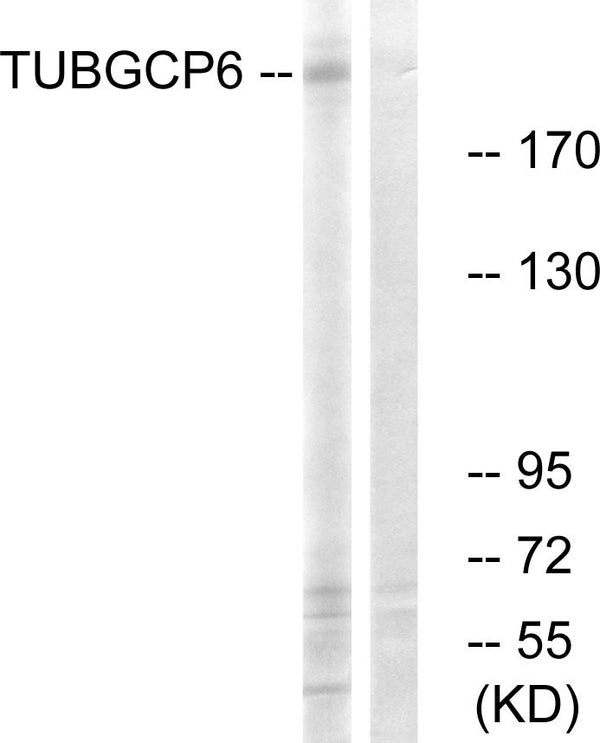 Anti-TUBGCP6 antibody (741-790 aa) (STJ93247) – Figure 1 of 1