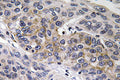 Anti-GUCY1B2 antibody (53-102 aa) (STJ93252) – Figure 1 of 1