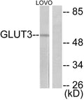 Anti-SLC2A3 antibody (447-496 aa) (STJ93294) – Figure 1 of 1