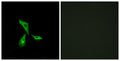Anti-GPR101 antibody (451-500 aa) (STJ93314) – Figure 1 of 1