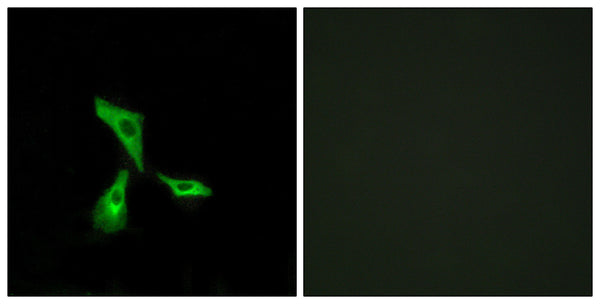 Anti-GPR101 antibody (451-500 aa) (STJ93314) – Figure 1 of 1