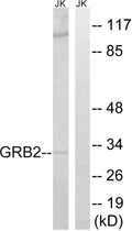 Anti-GRB2 antibody (141-190 aa) (STJ93421) – Figure 1 of 1