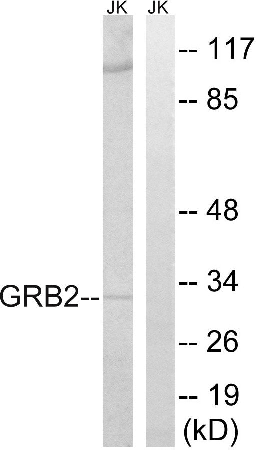 Anti-GRB2 antibody (141-190 aa) (STJ93421) – Figure 1 of 1