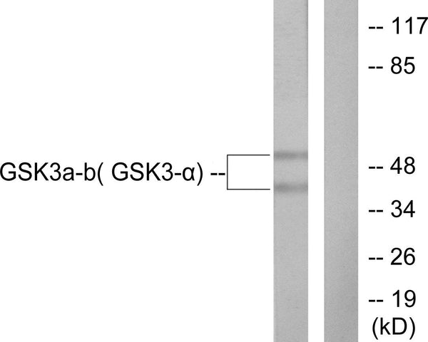 Anti-GSK3 Alpha/Beta antibody (246-295 aa) (STJ93446) – Figure 1 of 1