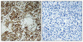 Anti-HLA-DOA antibody (71-120 aa) (STJ93542) – Figure 1 of 1