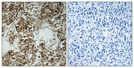 Anti-HLA-DOA antibody (71-120 aa) (STJ93542) – Figure 1 of 1