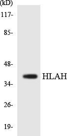 Anti-HLA-H antibody (71-120 aa) (STJ93545) – Figure 1 of 1