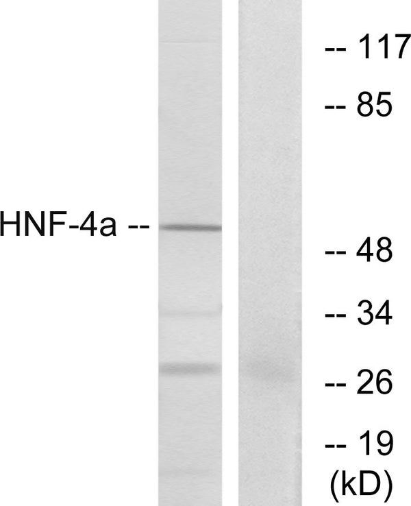 Anti-HNF4A antibody (280-329 aa) (STJ93554) – Figure 1 of 1