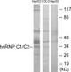 Anti-HNRNPC antibody (241-290 aa) (STJ93560) – Figure 1 of 1