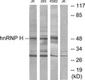 Anti-hnRNP H antibody (156-205 aa) (STJ93566) – Figure 1 of 1