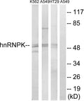 Anti-HNRNPK antibody (250-299 aa) (STJ93567) – Figure 1 of 1