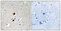 Anti-HNRNPLL antibody (241-290 aa) (STJ93569) – Figure 1 of 1