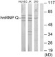 Anti-SYNCRIP antibody (236-285 aa) (STJ93571) – Figure 1 of 1