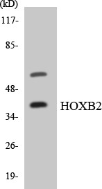 Anti-HOXB2 antibody (41-90 aa) (STJ93579) – Figure 1 of 1