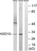 Anti-HOXD10 antibody (291-340 aa) (STJ93584) – Figure 1 of 1