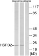 Anti-HSPB2 antibody (121-170 aa) (STJ93612) – Figure 1 of 1