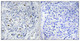 Anti-HK1 antibody (31-80 aa) (STJ93630) – Figure 1 of 1