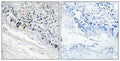 Anti-ITPKC antibody (221-270 aa) (STJ93719) – Figure 1 of 1
