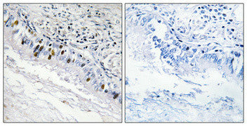 Anti-ITPKC antibody (221-270 aa) (STJ93719) – Figure 1 of 1