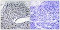 Anti-IRF3 antibody (351-400 aa) (STJ93761) – Figure 1 of 1