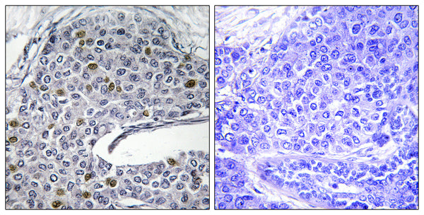 Anti-IRF3 antibody (351-400 aa) (STJ93761) – Figure 1 of 1