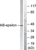 Anti-NFKBIE antibody (131-180 aa) (STJ93787) – Figure 1 of 1