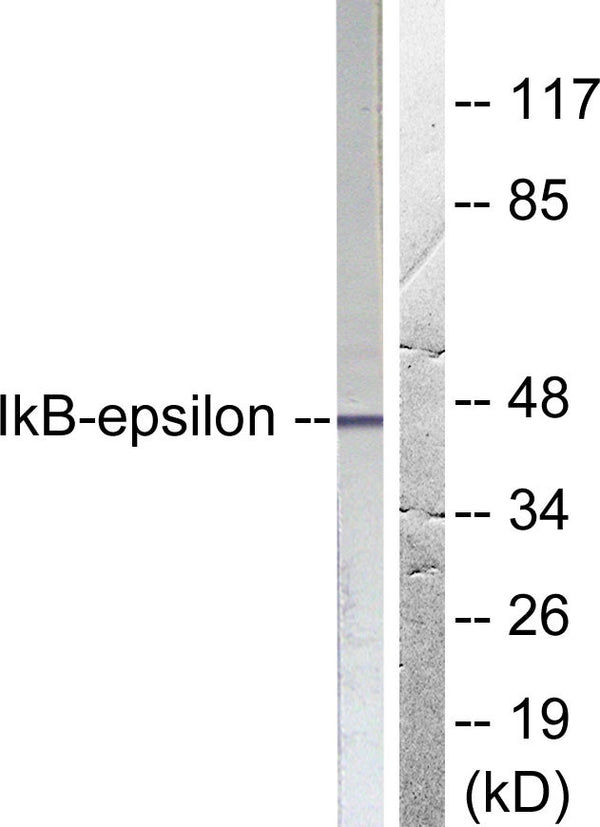 Anti-NFKBIE antibody (131-180 aa) (STJ93787) – Figure 1 of 1