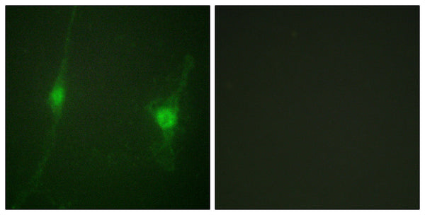 Anti-STK11 antibody (384-433 aa) (STJ93937) – Figure 1 of 1